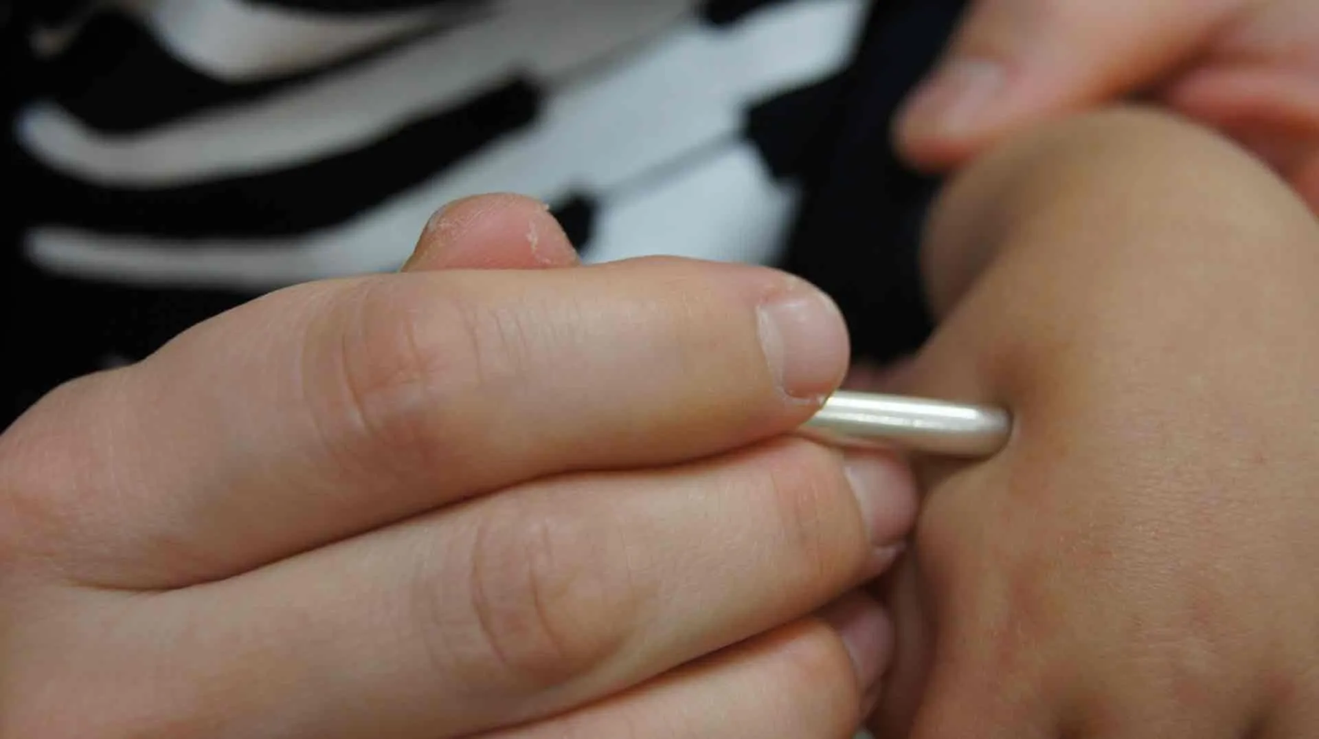 根本改善サポートコース