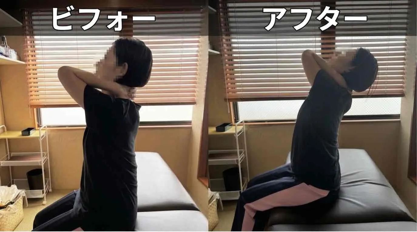 【埼玉県在住】30代女性 腰痛と身体の反らしづらさが改善した事例
